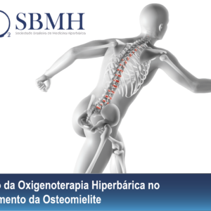 O uso da Oxigenoterapia Hiperbárica no Tratamento da Osteomielite<