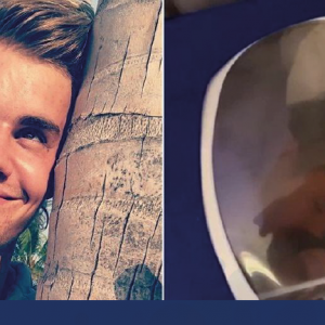 Justin Bieber faz tratamento de oxigenoterapia hiperbárica – Matéria Viva Bem UOL